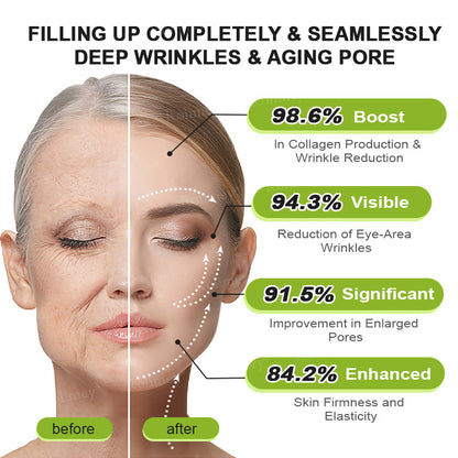 Rolimey® Botox & Vita A Retinol Shot Wrinkle-Lift Tightening cream