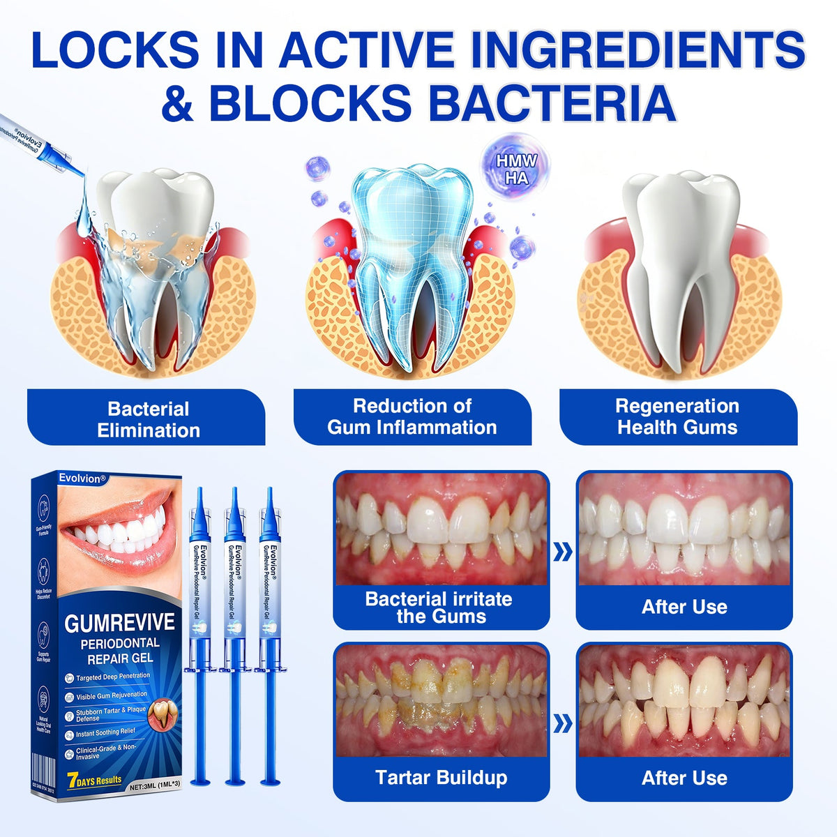 🔥 [BUY 1 GET 1 FREE] Evolvion® Targeted Gum Care Gel — Soothe Redness & Restore Firm Gums Overnight 🦷✨ (JG)
