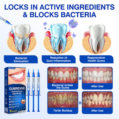 🔥 [BUY 1 GET 1 FREE] Evolvion® Targeted Gum Care Gel — Soothe Redness & Restore Firm Gums Overnight 🦷✨ (JG)