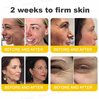 Rolimey® Botox & Vita A Retinol Shot Tightening Cream⬆️