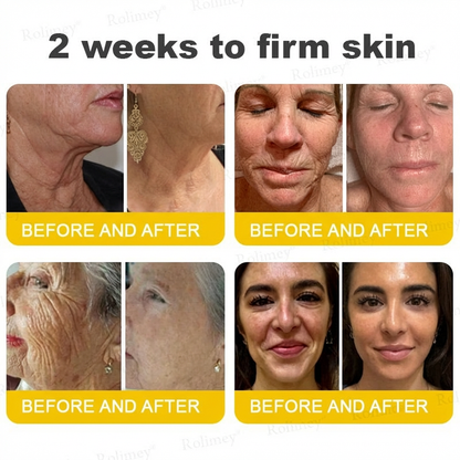 Rolimey® Botox & Vita A Retinol Shot Tightening Cream⬆️