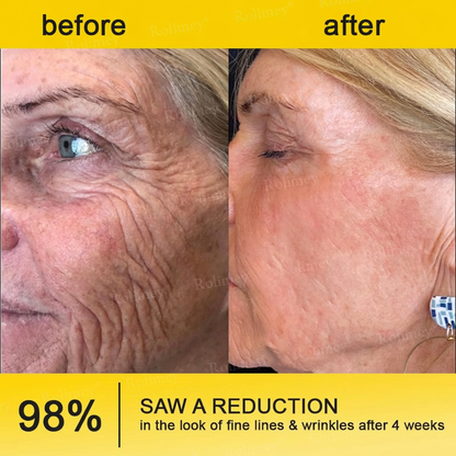 Rolimey® Botox & Vita A Retinol Shot Tightening Cream⬆️