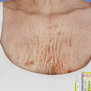 Rolimey® Botox & Vita A Retinol Shot Wrinkle-Lift Tightening cream (Upsell)